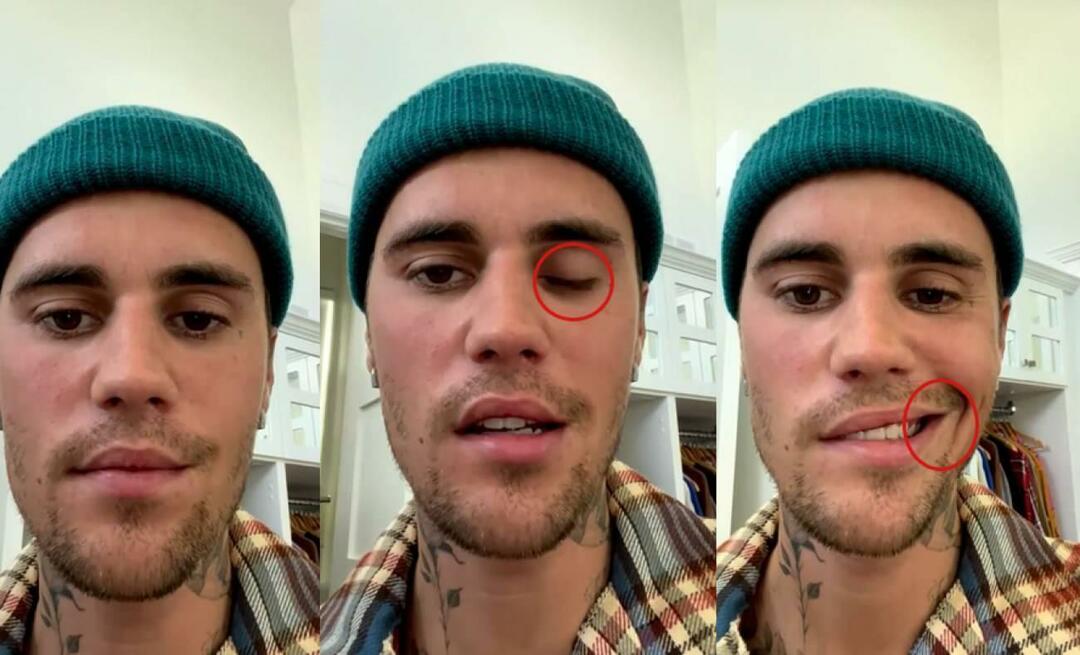 Justin Bieber had gezichtsverlamming! De beroemde ster kan niet nog een keer op wereldtournee gaan