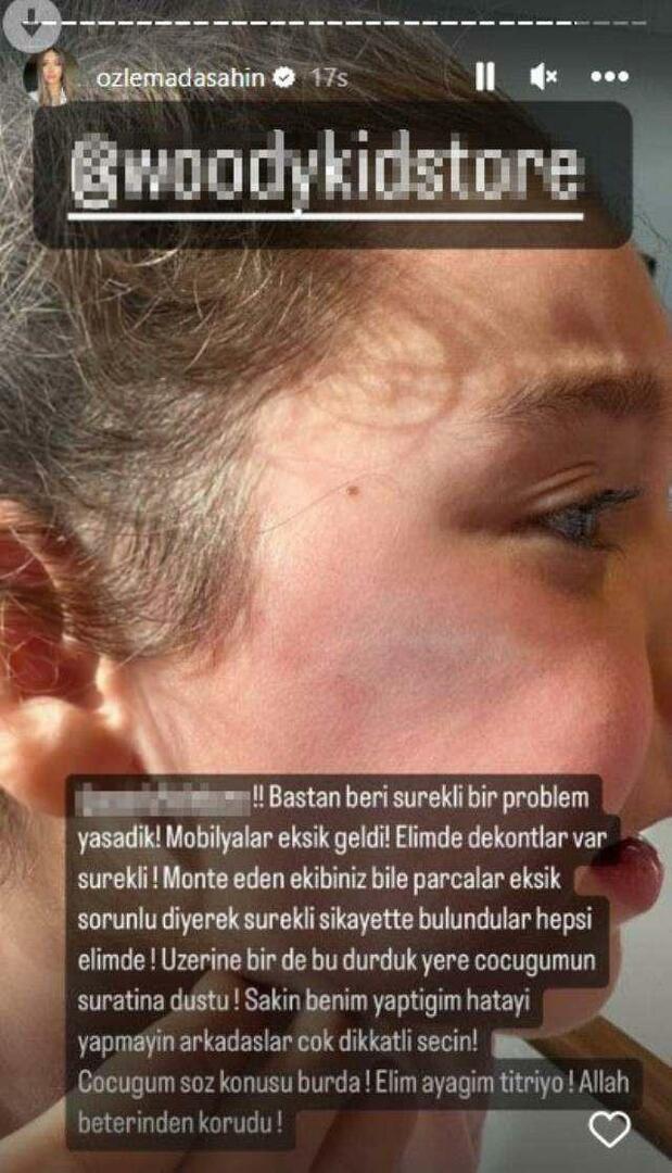 De kastdeur viel op het gezicht van de dochter van Berkay Şahin