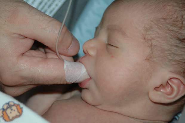 Wat is de Finger Feeding-methode? Hoe de baby voeden met een spuit?