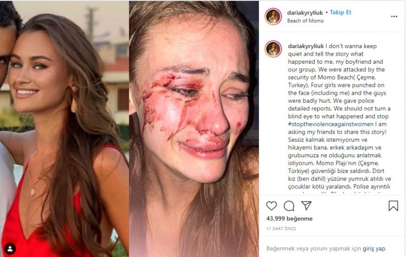 Oekraïens topmodel Daria Kyryliuk, naar verluidt geslagen in İzmir Çeşme, sprak voor het eerst!