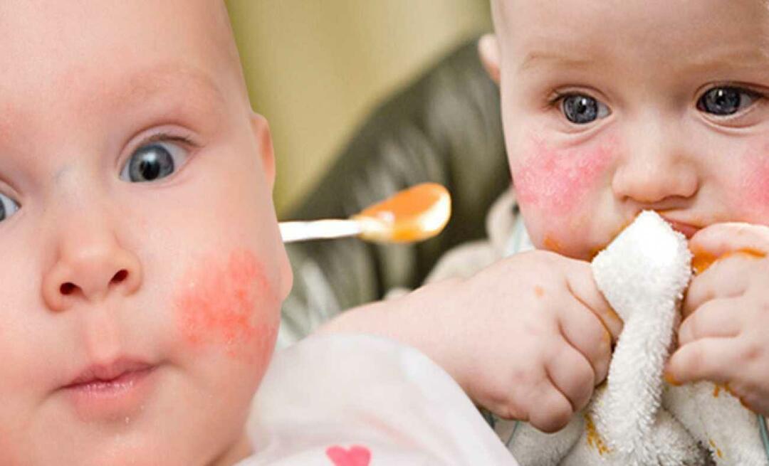 Wat moet een baby met allergieën eten? Wat zijn alternatieve voedingsmiddelen voor allergische baby's?