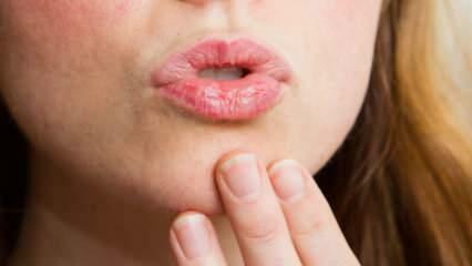 Hoe lipverzorging thuis doen? Eenvoudige verzorging van droge lippen in 4 stappen