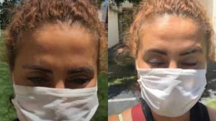 Esra Akkaya, die hetzelfde masker gebruikte, kreeg het virus! 