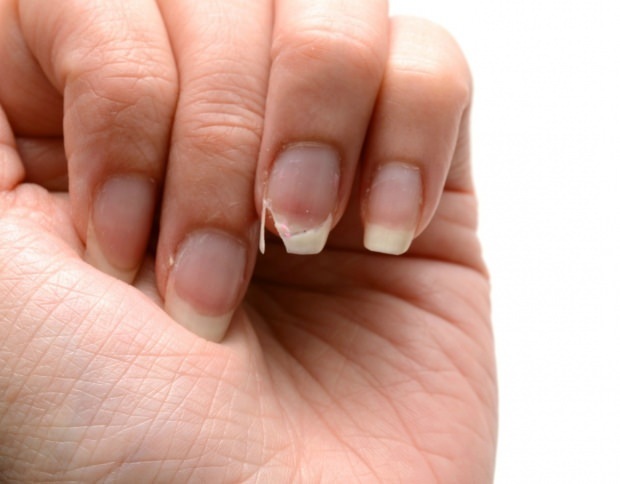 Hoe wordt nagelverzorging gedaan? Snelle nagelverlengingsmethoden