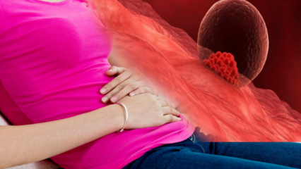 Wat is implantatiebloeding tijdens de zwangerschap? Hoe onderscheid te maken tussen implantatiebloedingen en menstruatiebloedingen
