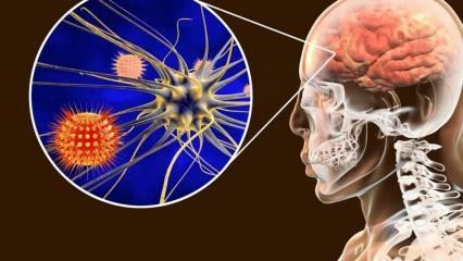 Wat is meningitis en wat zijn de symptomen? Is er een behandeling voor meningitis?